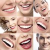Beauty Deals 44% Teeth Whitening Carbamide Peroxide Gel 10x 3cc