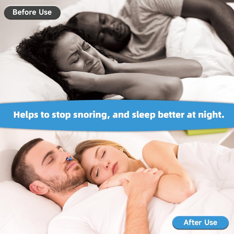 Anti Snoring Devices,Silicone Magnetic Stop Snoring Solution (White)