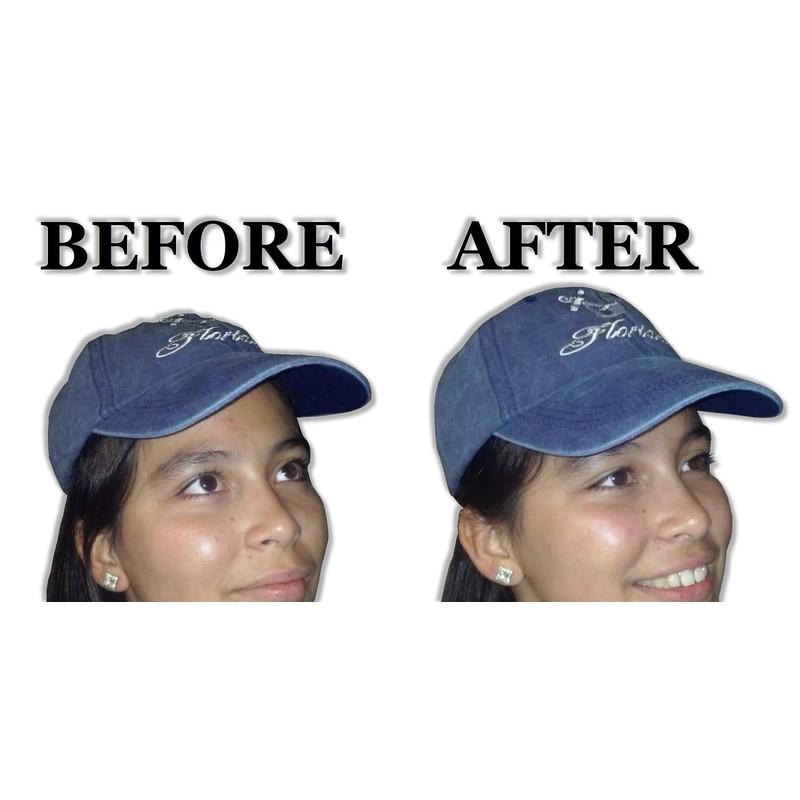 Deluxe Baseball Cap Panel Hat Shaper| Snapbacks, Fitted Cap| for