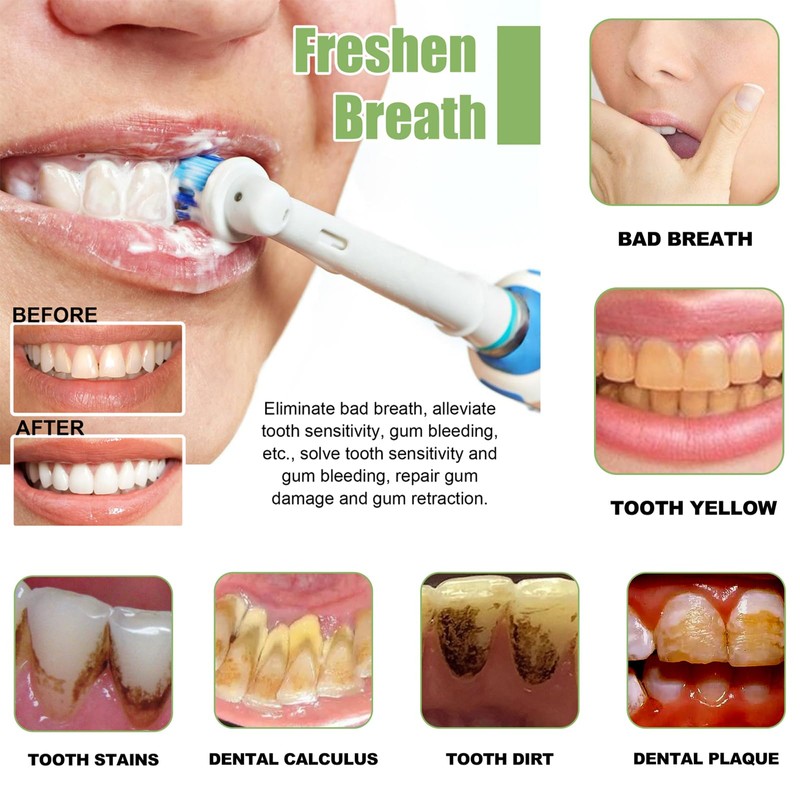 Tlopa Ampoule Toothpaste, Ksndurn Toothpaste, White Teeth, Pack of 20