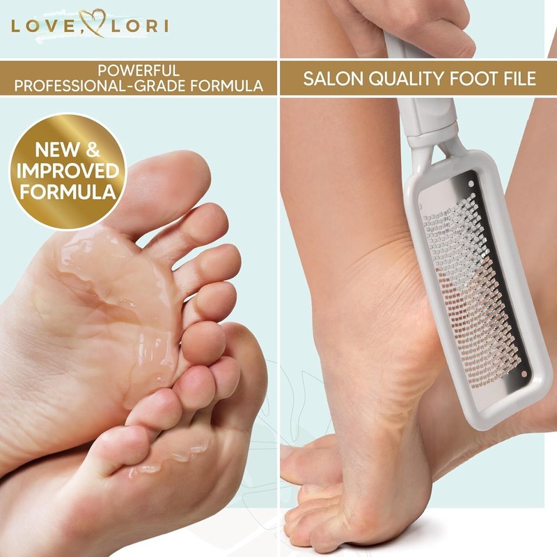 LOVE, LORI Foot Callus Remover - Pedicure Supplies Scrubber Dead