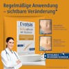 Evolsin Scar Patch with Hyaluronic & Patchtronic - For Surgical