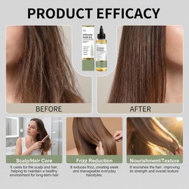 Ultimate Rosemary & Batana Hair Growth Oil, Light Non-Greasy Scalp Serum,Nourishes Repairs Damaged,Reduces Loss Boosts Density Thickens Strands for All Hair Types Men Women (3pcs)