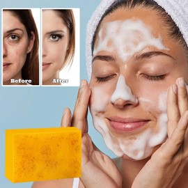 Jabon de Curcuma para Las Manchas, Crema para Manchas Oscuras en La Cara, Jabón para La Cara, Jabón de Cúrcuma Con Vitamina C para Cara y Cuerpo, Piel Hidratante de Piel Sensible Soap, 100g