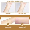 6PCS Concealer Sticker,Invisible Scar & Tat/too Cover-Up Patch,Waterproof Tat/too Cover