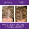 Omni Bioceuticals Healthy Growth Hair Complex with M-007®, Growth Factors