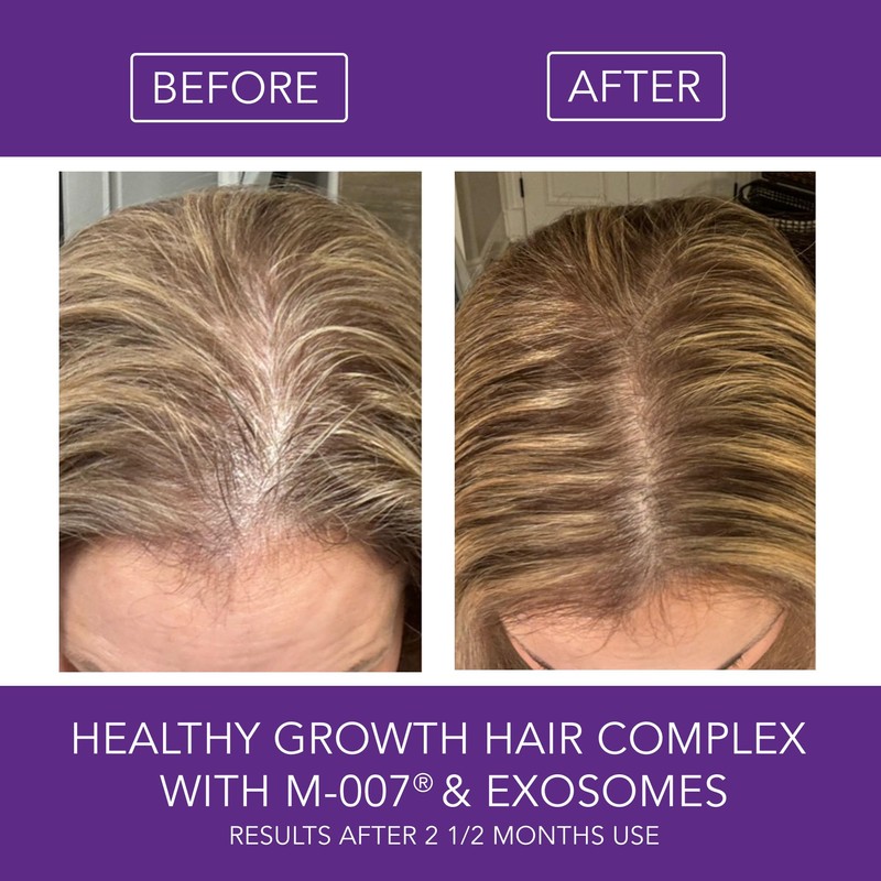 Omni Bioceuticals Healthy Growth Hair Complex with M-007®, Growth Factors