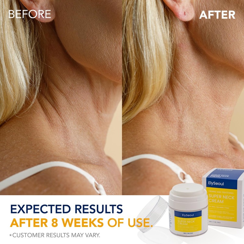 ElySeoul ElySeoul Korean Neck Cream for Firming & Tightening: Neck