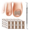 FERYES 50 PCS Breathable Ingrown Toenail Corrector Patch with Double-Ended