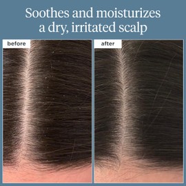 Briogeo Scalp Revival Rosemary Pre-Wash Oil | Moisturizing Scalp Treatment for Dry, Flaky, or Itchy Scalp | Strengthens Hair & Soothes Scalp | Vegan & Cruelty-Free | 3.4 oz