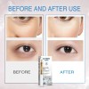 Crema Antiarrugas Para Ojos, Sérum Reafirmante De Bolsas De Madura
