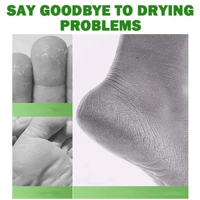 Tea Tree Oil Foot Cream for Dry Cracked Skin, Intensive