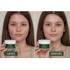 Crema Herbal Tratamiento Acné, Control Grasa, Minimiza Poros