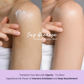 Vigority Keratosis Pilaris Treatment Cream with Lactic Acid – KP Body Bump Exfoliating Moisturizer for Rough, Bumpy, Dry & Flakey Skin, Strawberry Legs – 5.1 Oz