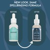 Nature Spell 2% BHA Liquid Exfoliant, Minimises Pores & Prevents