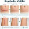 Parches Silicona para Cicatrices – Láminas Reutilizables para Cesárea y