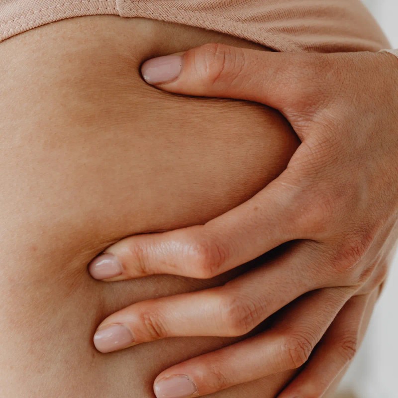 Crema Prenatal Antiestrias Rusens Extra Humectante