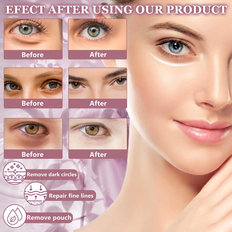 Jasmine Ointment Plus, 100 ml Jasmine Ointment Eyes, Eye Active