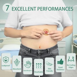 XIIFIIFII XIIFIIFII 30Pcs Ostomy Barrier Rings, 2mm Thickness Hydrocolloid Tape Cohesive Seals, Elastic Moldable Skin Extender, Ostomy Supplies for Colostomy, Ileostomy & Urostomy Bags