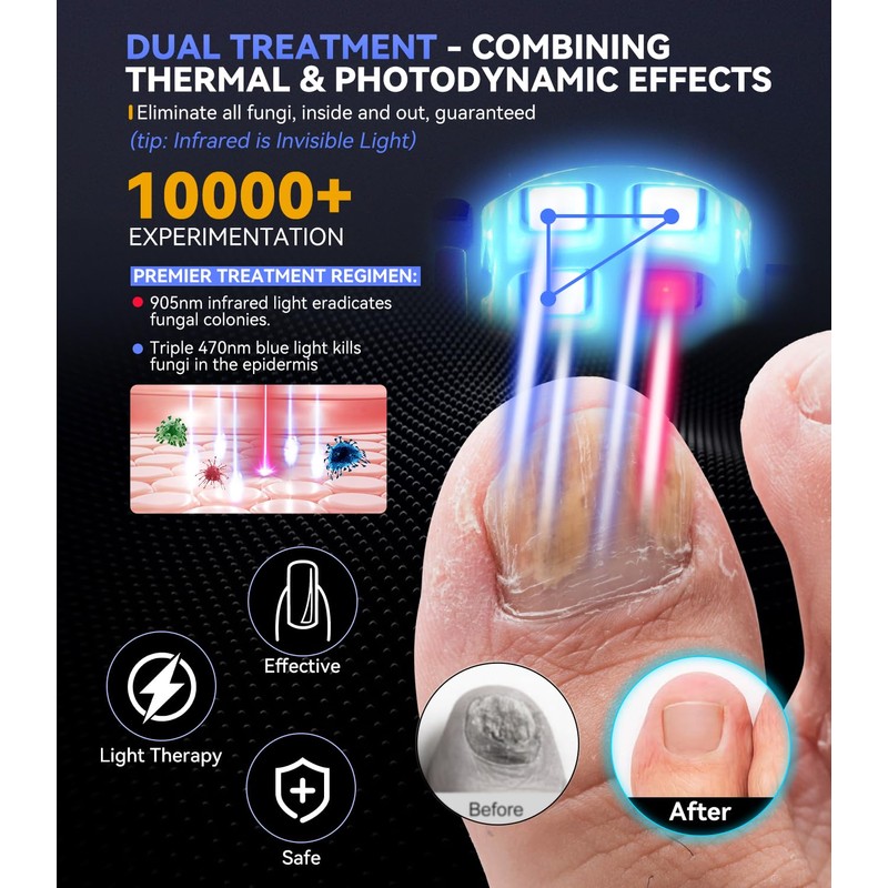 Nail Fungus Laser Device