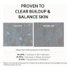 Arencia Eraser Shot Serum Glycolic Acid Booster With Aha Bha