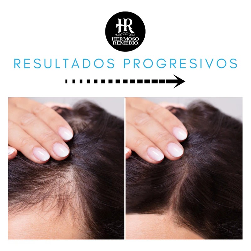 6 Shampoo Anticaida Crecimiento Caspa Reparador Hombre 7en1