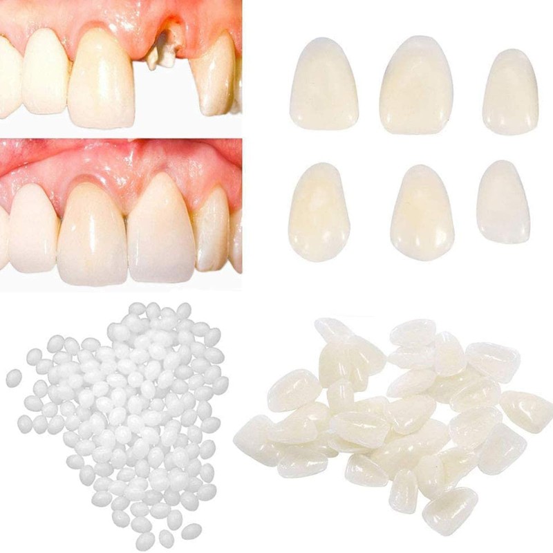 ShuaWdk Dentures, Dental Resin, Fitting Beads Teeth, Teeth Repair Kit
