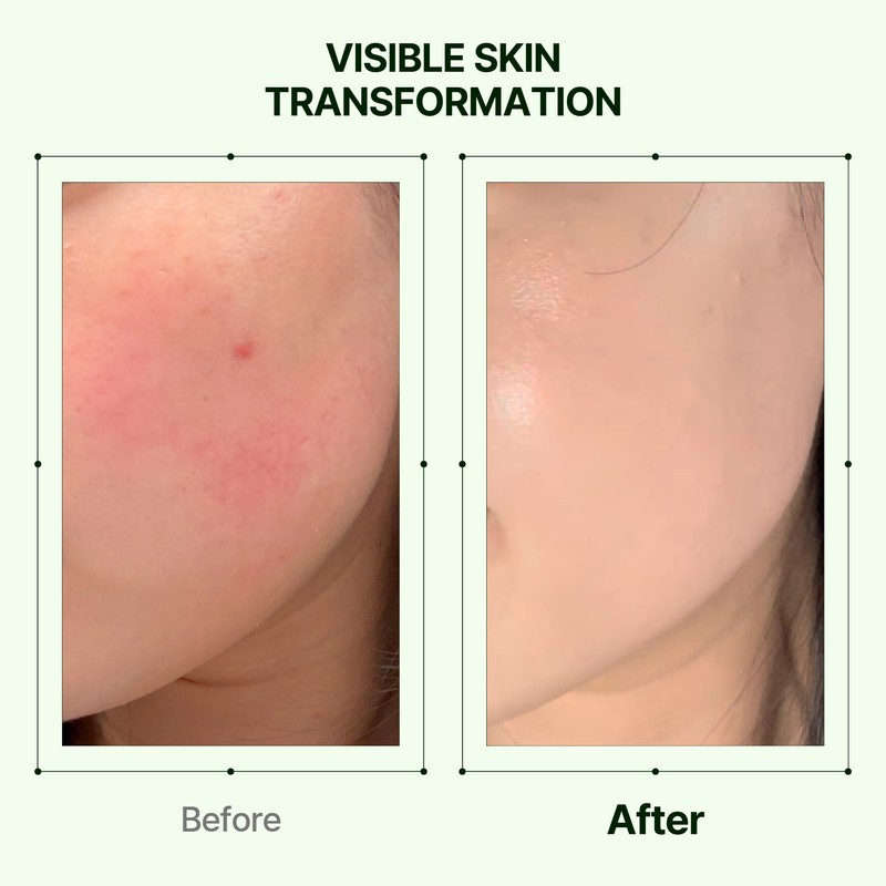 Orien Mugwort Zero Film Moisturizer 60ml Niacinamide 2% panthenol glycerin