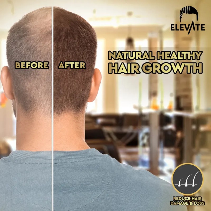 A Cjw H.. Sérum For El Crecimiento Del Cabello Elevate