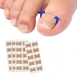 Ingrown toenail tape 10p to prevent toenail bending of big toe RD-11991 6ea