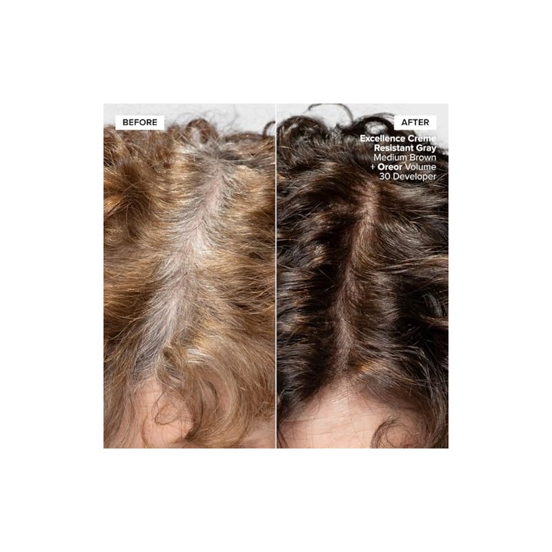 L'oreal Excellence CrÃƒ¨me Superior Grey Coverage, 5X Medium Brown, 1.74