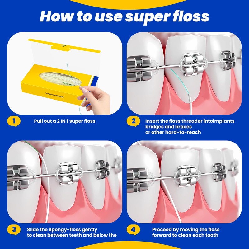 COCOBURI Dental Floss for Braces,Pre-Cut Strands Floss,Threaders for Bridges,Threaded Floss
