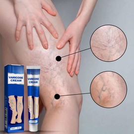 Crema Reparadora de Patas de Araña, Varicoso Vena Calmante Pierna Crema (Blue, 1 Piece)