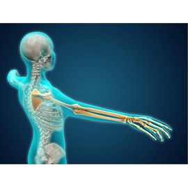 ART.COM Stretched Canvas Print X-Ray View of Human Body Showing Skeletal Bones in the Arm and Hand, 24" x 18"