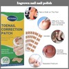 50 pieces toenail patch, toenail correction patch, corrector pedicure tools,