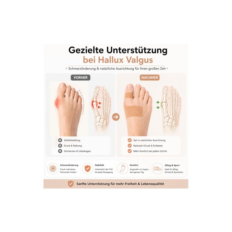 Neujus Hallux Valgus Kinesiotape - 24 Precut Elastic Sports Tape