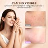 Corrector en Crema Mate Hidratante 2 Unidades – Cobertura Total