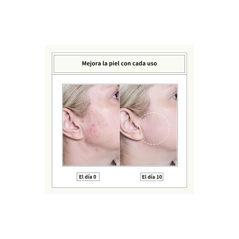 Cistto Aceite Limpiador Natural -todo Tipo De Piel 2ml *