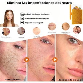 1 Pcs Jabón Turmeric Soap, Jabón de Cúrcuma y Ácido Kójico,Hidratación Profunda, Iluminador de Piel, Reduce Manchas Oscuras y Acné, Suave para Piel Sensible,Mixta,Grasa y Seca (Cara y Cuerpo)