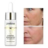 Lanbena Sérum Hidratante Antiacné con Ácido Hialurónico 3 Piezas