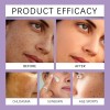 2pcs Crema Epiglow Melanex Advanced Anti-hiperpigmentación