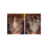 Sistema Novocrin Tratamiento Completo