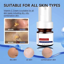 Dark Spot Correcting Serum ， Moisture Skin Brightening Skin Repairing Face Serum， Helps Even Tone, Reduces Dark Spots, Hydrating Renewing Formulated，Gentle care for the (4PCS)