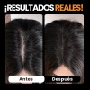 Polvo De Maquillaje De Fibra Capilar Cubre Raíz De Cabello