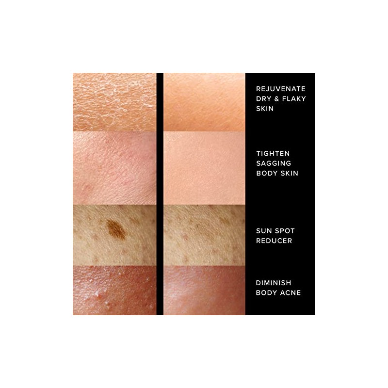Crema reafirmante corporal orgánica - Reduce la aparición de estrías,