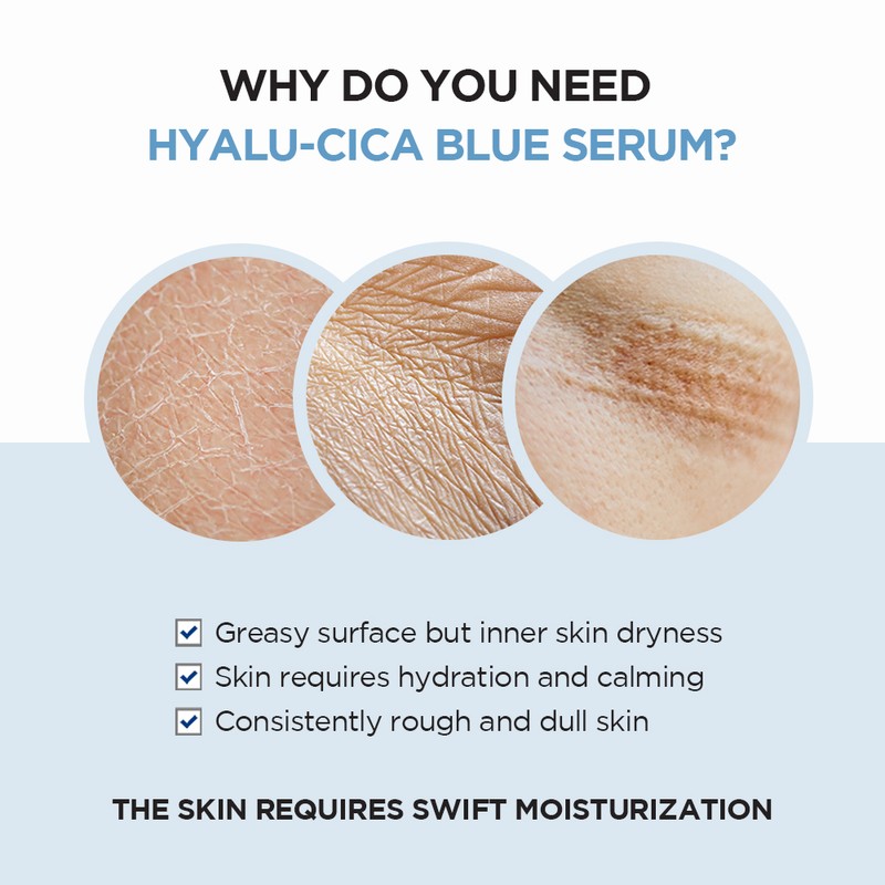 SKIN1004 [SKIN1004]Madagascar Centella Hyalu-Cica Blue Serum 50ml