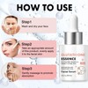2PCS GLUTATHIONE ESSENCE Enriched With Glutathione Vitamin C & Kogke