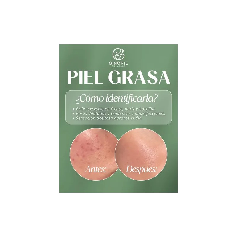 Kit Ácido Hialurónicocremahumectanteserum Piel Grasa 7pza