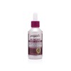 Groganics On The Spot Itch Relief Scalp Drop 120 ml