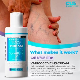 Clg Skincare - Crema Para Venas Varicosas, Loción De Rescate                                                                                          